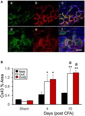 Role of Connexin 43 in an Inflammatory Model for TMJ Hyperalgesia